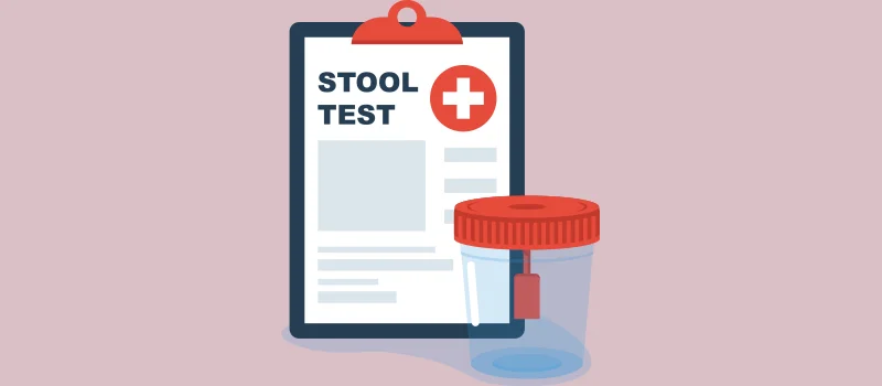 Fecal Occult Blood Test: What Is It and What Can It Detect?