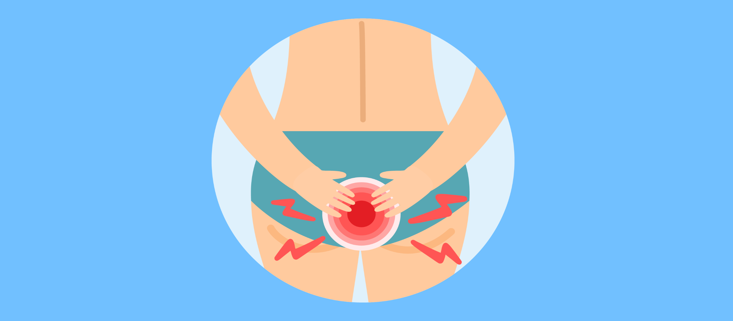 Why Do Hemorrhoids Itch? Causes and Treatment Options